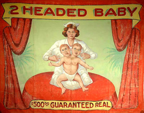 2-headed-baby_cropped